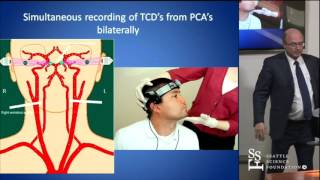 Head Turn Syncope Rotational Vertebrobasilar Ischemia by David Newell MD [upl. by Elli]