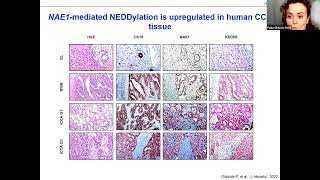 ICRNENSCCA Webinar Targeting NAE1mediated protein hyperNEDDylation halts [upl. by Andros]