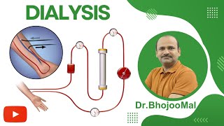 Dialysis  Hemodialysis CRRT  Class 12 Biology  by Dr Bhojoo Mal [upl. by Hilel]