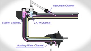 OERPro Uses Connector Overflow System [upl. by Boswall]