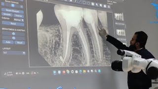 SLOB rule technique Xray  mesial shift Vs Distal shift [upl. by Todd]