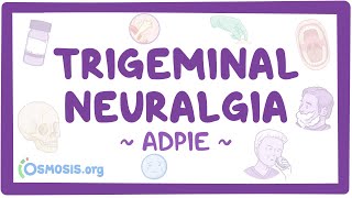 Trigeminal neuralgia Nursing Process ADPIE [upl. by Aicia]