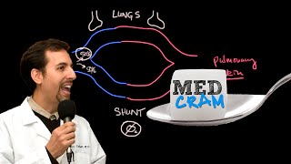 Shunting Explained Clearly Pulmonary Shunt [upl. by Leodora35]