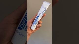 Adapalene Gel For Lightening Sun Spots dermatologist [upl. by Aliak]