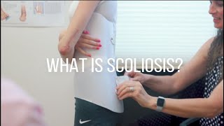 Scoliosis Treatment Symptoms and Causes [upl. by Ayatnwahs]