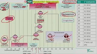 Neonatología  Hemorragia intraventricular leucomacia periventricular paralisis cerebral [upl. by Anelad523]