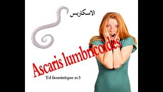 TD faunistique  Ascaris lumbricoides b DARIJA sv3 لاينصح به أصحاب القلوب الضعيفة [upl. by Lasser]