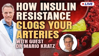 Dr Mario Kratz This Is How Insulin Resistance Clogged Arteries [upl. by Jerald]