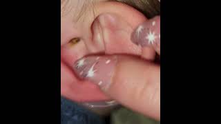 Ear cleaning Ear wax cleaning  satisfying diy treanding [upl. by Posehn]