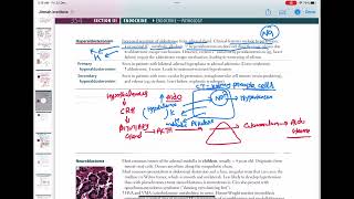 Hyperaldosteronism endocrinology 77  First Aid USMLE Step 1 in UrduHindi [upl. by Conlin]