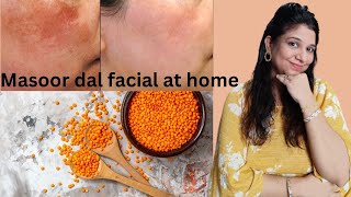 Masoor dal facial  Facial for pigmentation dark spots and tanning skin whitening facial [upl. by Arrad743]