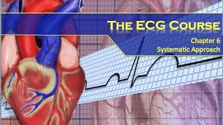 The ECG Course  Systematic Approach [upl. by Giverin556]