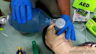 BLS  Supraglottic Airway Device SAD [upl. by Si]