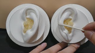 ASMR Your ears are full of earwax 7  Pop Rocks  Popping Sound  Ear Cleaning No Talking [upl. by Damon]