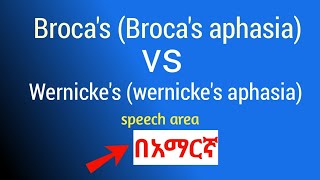 Brocas aphasia vs Wernickes aphasia Brocas vs Wernickes speech area in amharic በአማርኛ [upl. by Eisej]