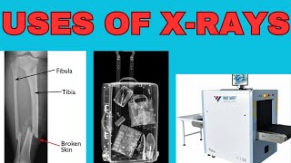 Uses of Xrays l Applications of Xrays l in Hindi l Radiology l Education l Science l Technology [upl. by Bright]