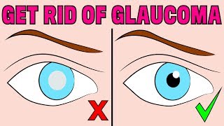 How to reverse chronic glaucoma naturally in 4 minutes a day [upl. by Atnahsal782]