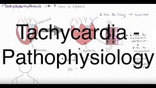 Pathophysiology of Tachydysrhythmia [upl. by Rama]