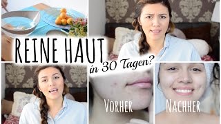 REINE HAUT in 30 Tagen VorherNachher BetterSkinwithAnna [upl. by Yousuf685]