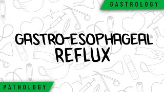 GastroEsophageal Reflux  Physiopathology Symptoms Complications Treatment [upl. by Stoddart549]