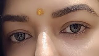 How to reduce dark circles  in Bengali [upl. by Schroeder121]