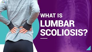 What Is Lumbar Scoliosis [upl. by Sirtimed]