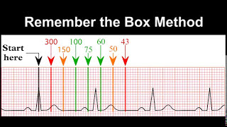 ECG Practice Test [upl. by Paul361]