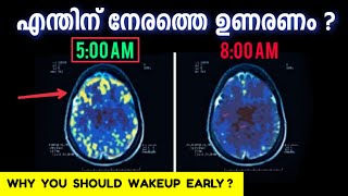 അതിരാവിലെ ഉണരൂ   കാരണം ഇതാണ്⚡️   Benefits of waking up early in the morning [upl. by Aimek]