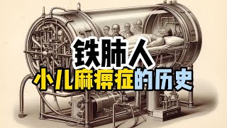 小兒麻痺曾經是令人恐懼的大流行病 [upl. by Ahsaercal]