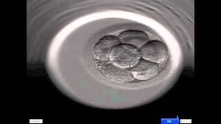 INSTITUT MARQUÈS  Ansicht der Entwicklung eines menschlichen Embryos durch das Embryoscope [upl. by Ecirtahs789]