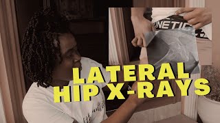 Lateral Hip Xray Positioning amp Centering Tips w Demo  Ask The Rad Tech [upl. by Azile128]