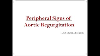 Peripheral signs of Aortic Regurgitation Dr Sameena Farheen [upl. by Aynek]