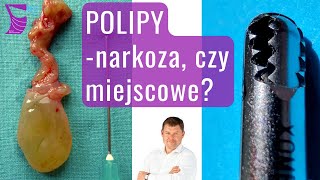 Usuwanie Polipów — Narkoza czy Znieczulenie Miejscowe [upl. by Weyermann]