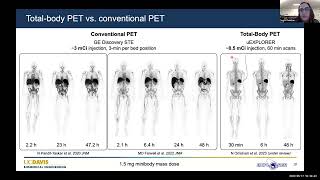 Australian Total Body PET Webinar 3  ImmunoPET imaging of COVID19 patients with Dr Negar Omidvari [upl. by Schalles]