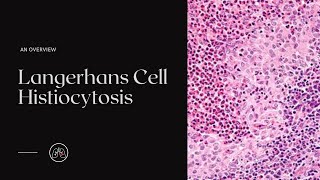 What is Langerhans Cell Histiocytosis [upl. by Piwowar]