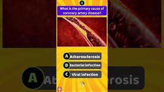 Whats REALLY Causing Coronary Artery Disease [upl. by Arica42]