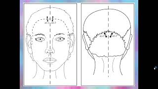 Basic Points YNSA Scalp Acupuncture [upl. by Yleve323]