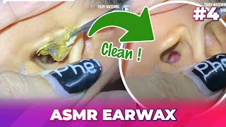 4 Earwax ASMR  Always keep your ears clean [upl. by Aicelet]