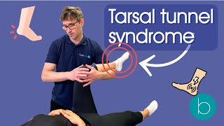 Tarsal Tunnel Syndrome  Everything You Need To Know [upl. by Pickford]