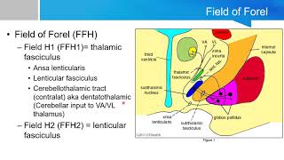 Neurosurgery written board crash course  basal ganglia part 2 [upl. by Blinny]