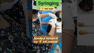 SYRINGING IRRIGATION OF EAR CANAL A STANDARD METHOD OF EARWAXREMOVALearcleaningviralvideoyoutube [upl. by Asiram]