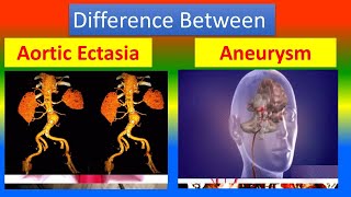 Difference between Aortic Ectasia and Aneurysm [upl. by Chet]