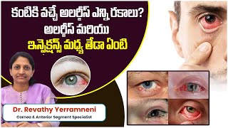 Conjunctivitis Causes Symptoms and Treatment  Types of Eye Infections  Smart Vision Eye Hospital [upl. by Eneirda]