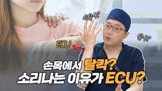 손목이 빠진거같고 탈칵 소리가 나는데 이유가 이씨유 ECU 새움병원 [upl. by Bertram965]