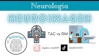 Neuroimagen  ¿Cómo Diferenciar Entre Una TAC Y Una RM [upl. by Airenahs]