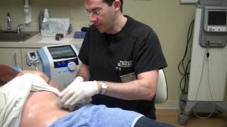 Exilis for Fat Reduction amp Skin Tightening on Stomach [upl. by Arvad73]