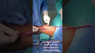 Central quadriceps tendon graft harvest [upl. by Delanos]