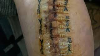 ZIP TIE SUTURES  ZIPSTITCH WOUND CLOSURE WEAK STOMACHS DO NOT WATCH  Angies Life [upl. by Haerdna]