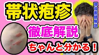 【保存版】帯状疱疹の原因・症状・治療法をまとめて簡単に解説します【2024年 医師解説】 [upl. by Duston835]