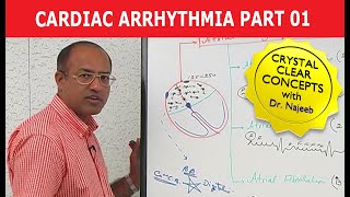 Cardiac Arrhythmia  Part 13 [upl. by Yelrahs]